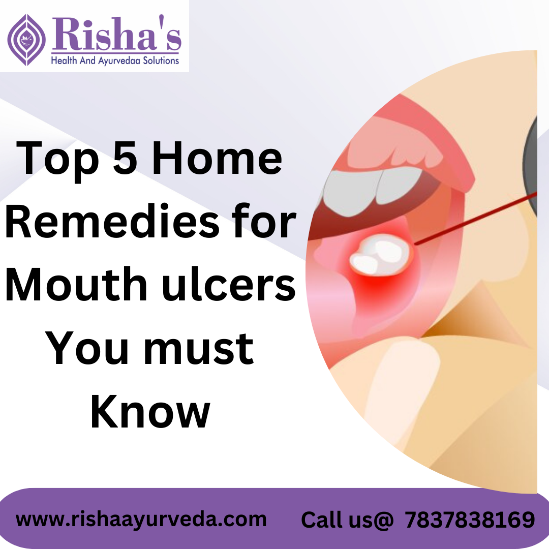 home remedies for mouth ulcers