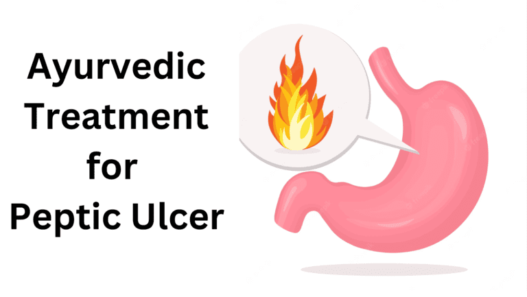 Ayurvedic treatment for peptic ulcer