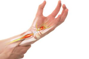 Carpal Tunnel Syndrome: Causes, Symptoms, and Ayurvedic Treatment